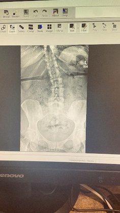 BayCare Outpatient Imaging (Van Dyke)