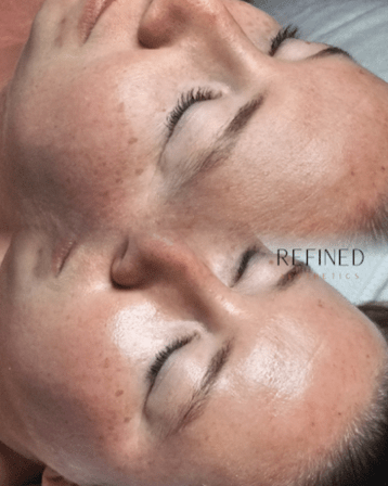 Refined Aesthetics - St. Pete facials and waxing