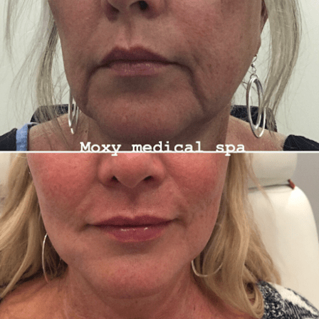 Moxy Medical Spa