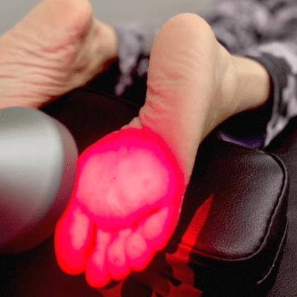 Wesley Chapel Neuropathy, Tampa Neuropathy Treatment by Optimize Wellness Center