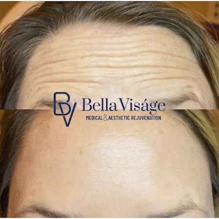 Bella Viságe Medical & Aesthetic Rejuvenation