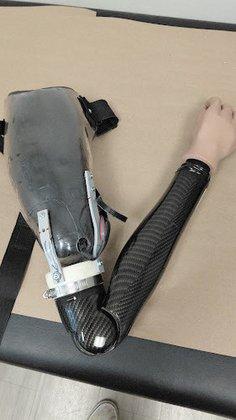 Hanger Clinic: Prosthetics & Orthotics