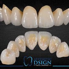 Aesthetic Dsign Dental Laboratory