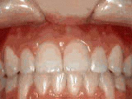 Marsh Orthodontics - William F Marsh DDS
