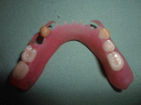H.I. Dental Lab Fl