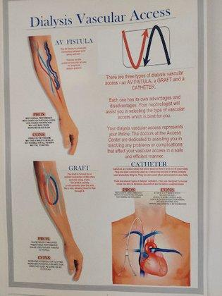 Vascular Action, LLC