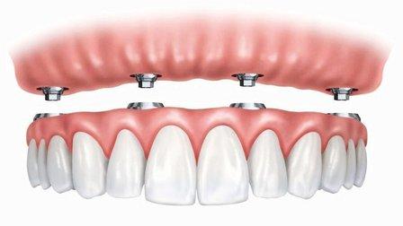 Artistic Dental Associates