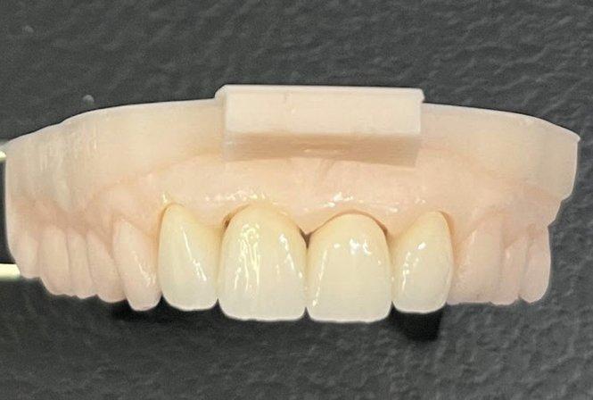 New Designs Dental Lab