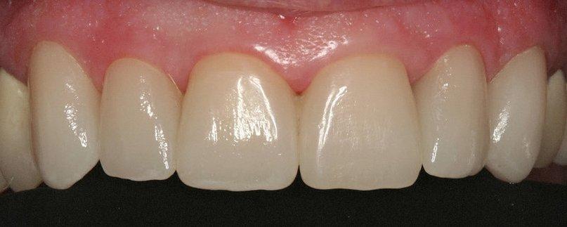 William J. Kinzler, DDS, MAGD, FICOI