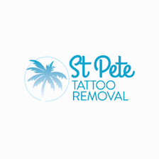 St Pete Tattoo Removal