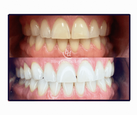 Bliss Dental Lounge