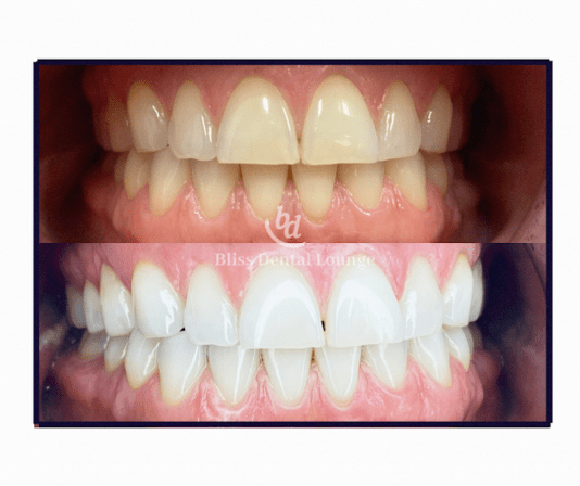 Bliss Dental Lounge