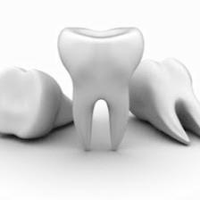 Designing Smiles