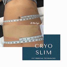 Body Sculpting of St Petersburg (Cryo Slimming/Toning/Facial) and Light Therapy