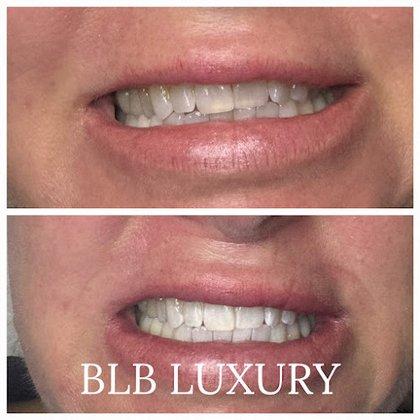 BLB LUXURY