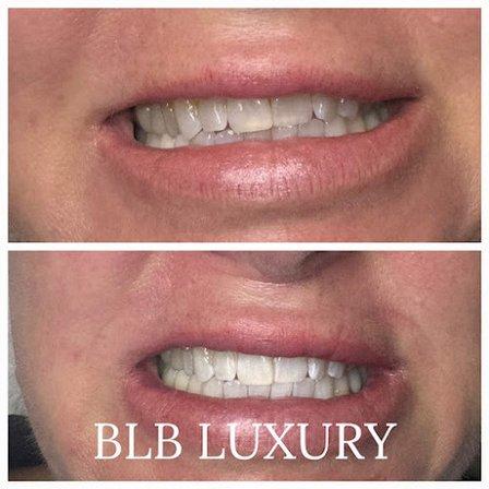 BLB LUXURY