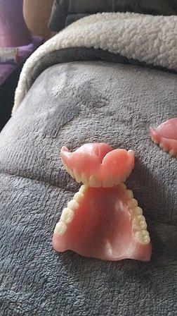 Affordable Dentures & Implants
