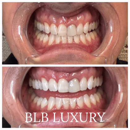 BLB LUXURY