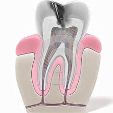 Pinellas Endodontics, PA