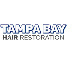 Tampa Bay Hair Restoration