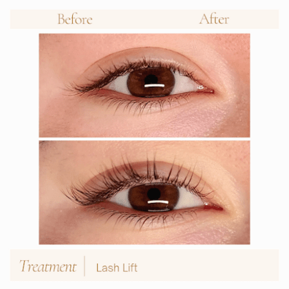 Seen Esthetics - Skin Care Facial Spa & Wax