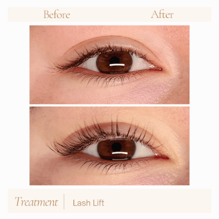 Seen Esthetics - Skin Care Facial Spa & Wax