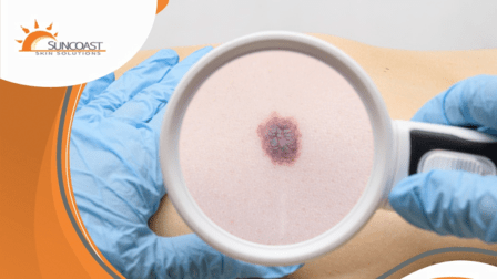 Suncoast Skin Solutions