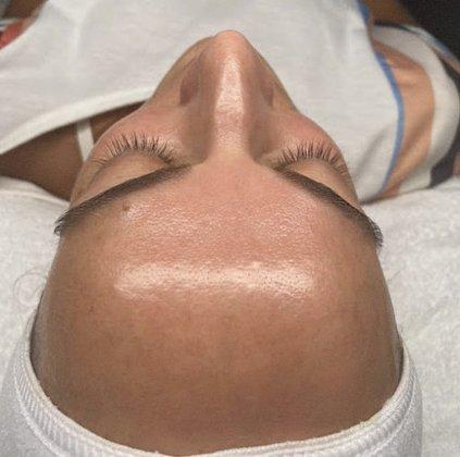 Glow Life Clear Skin Brandon