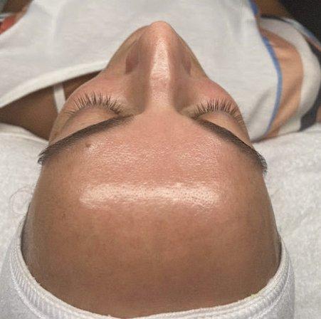 Glow Life Clear Skin Brandon