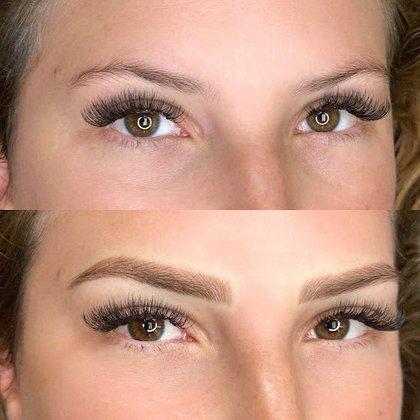 Crowning Brows