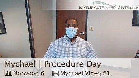 Natural Transplants, Hair Restoration Clinic