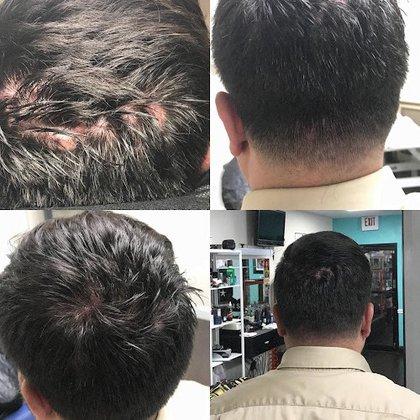 Tampa Scalp Ink