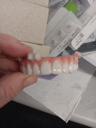 TW Denture Repair