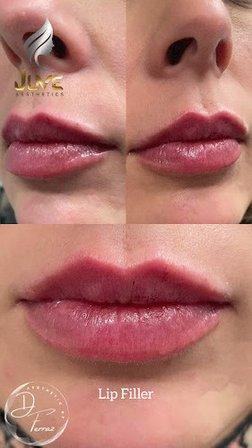 Juves Aesthetics & Cosmetic Procedures