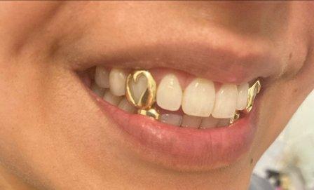 Grillzpro