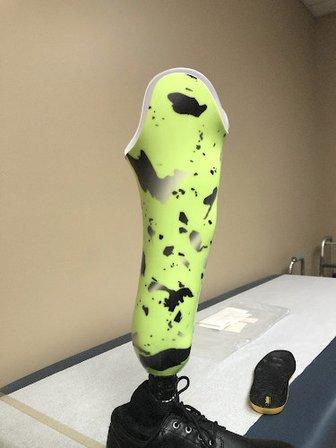 Tropical Sky Orthotics & Prosthetics