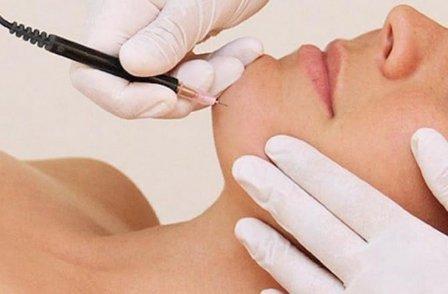 Elite Electrolysis Studio