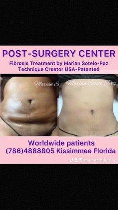 Medical Massage Professionals - Marian Sotelo-Paz | Post-Surgery, Lymphatic Drainage and Fibrosis Expert