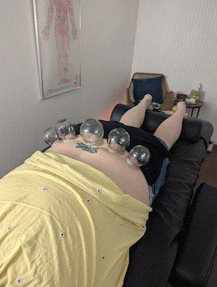 Lunas Acupuncture and Wellness