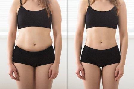 Flawless by Inathe -- Skin Firming, Body Sculpting and Scar Revision