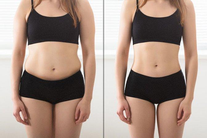 Flawless by Inathe -- Skin Firming, Body Sculpting and Scar Revision