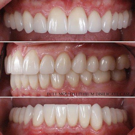 Altior Dental Ceramics