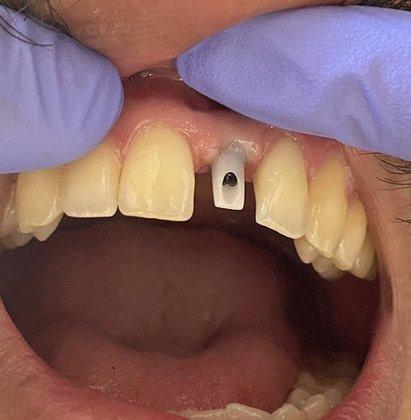 NXT LVL Dental Lab