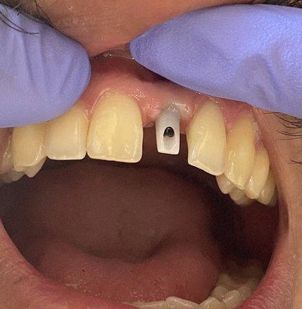 NXT LVL Dental Lab