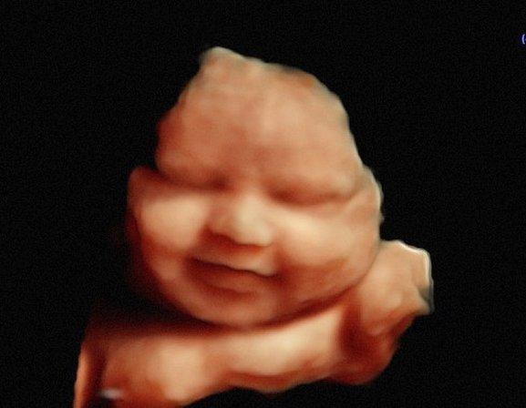 Life Imaging 3d 4D HD Ultrasound New Port Richey