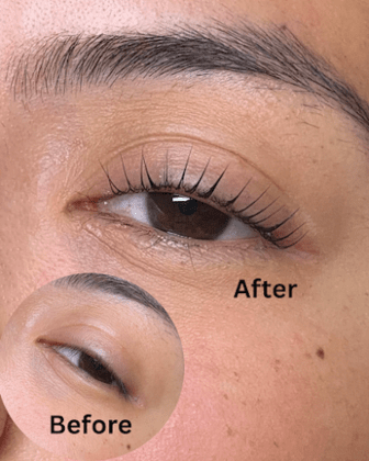 That Beauty Spot