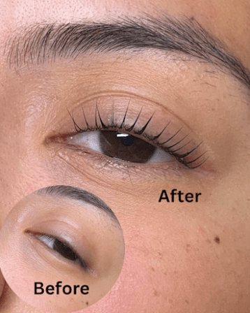 That Beauty Spot