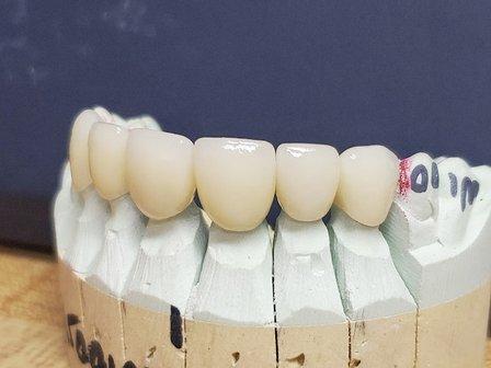 Sunshine Dental Lab