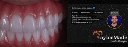 Taylor Made Smile Design LLC