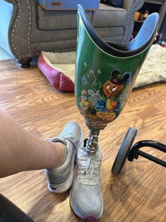 Orthotic Prosthetic Center Inc